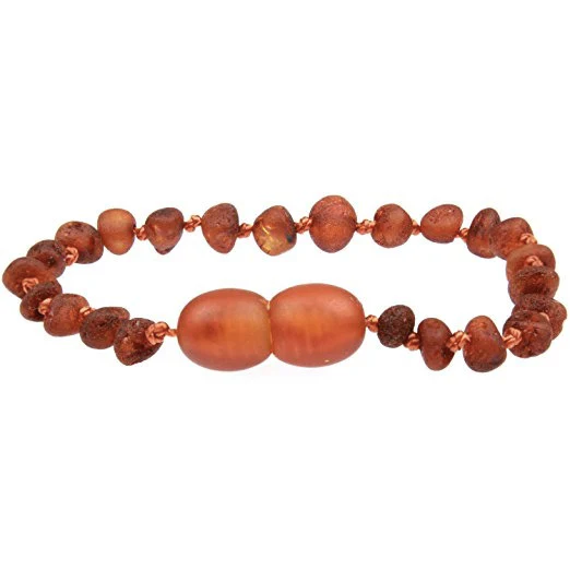 Baltic Amber Bracelet or Anklet - Raw Cognac - Children's - Image 3